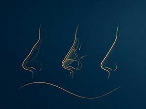 proyekto ng rhinoplasty